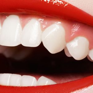 Как сохранить зубы до старости - секреты индийцев